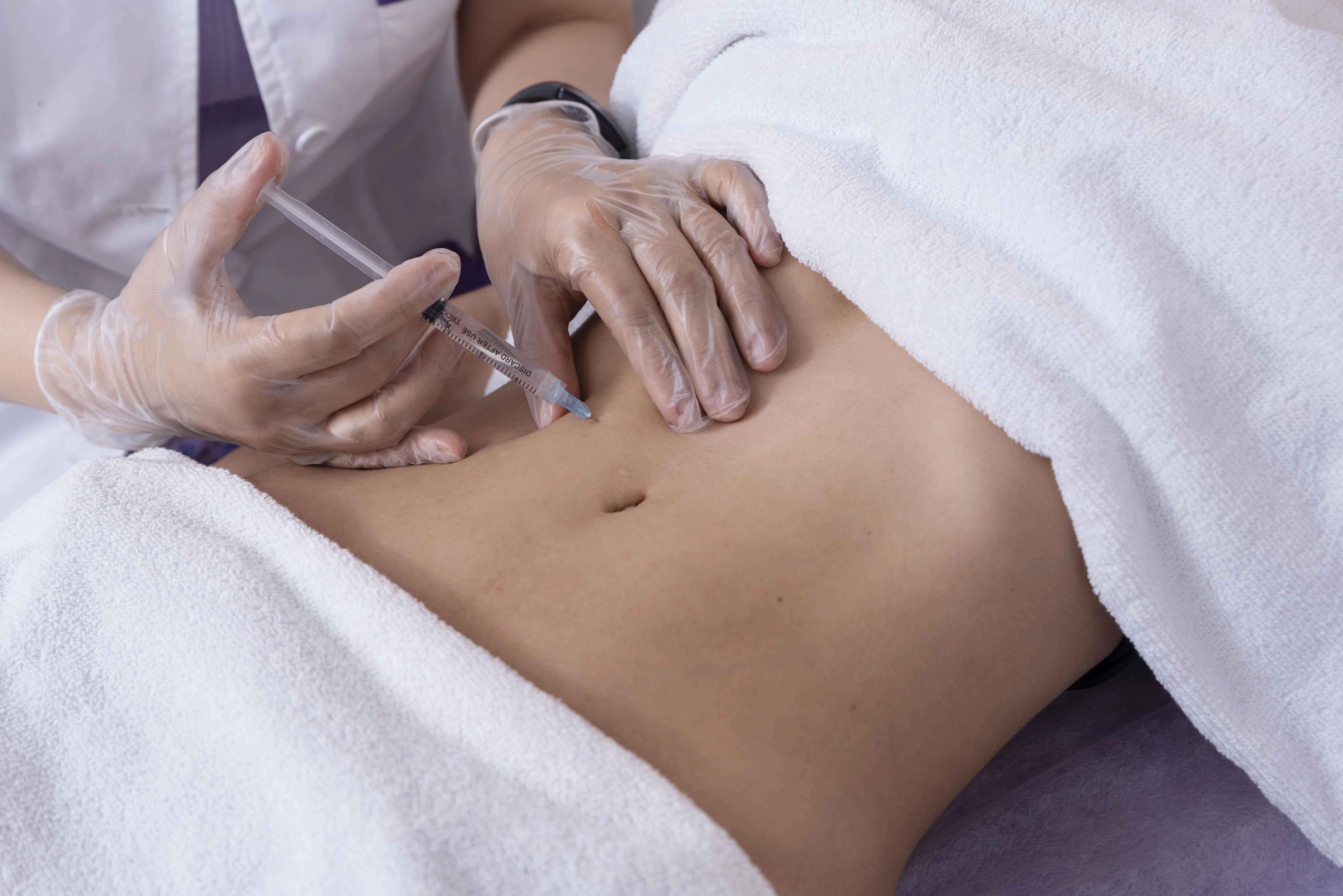 Mesoterapia abdominal: empieza 2026 cuidando tu cuerpo